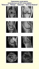 A comparison of the tomograms obtained by MRI "Unitom", "Philips", "Siemens", "General Electric"